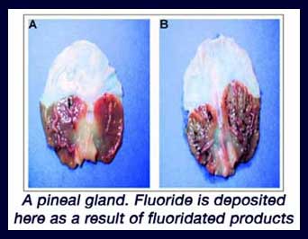 pineal_fluoride